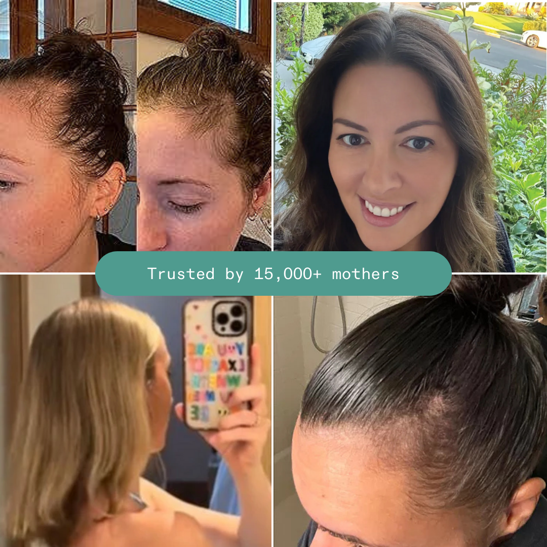 Copper Peptide Serum for Postpartum Hair Loss